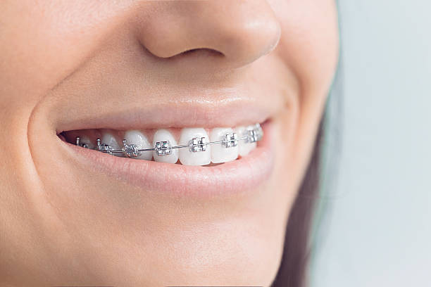 Best Teeth Whitening  in Apple Creek, OH